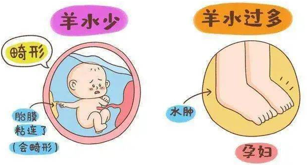 羊水问题有哪些症状？