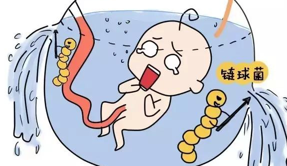 羊膜腔感染的风险因素有哪些？