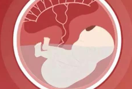 羊膜腔感染的并发症有哪些？