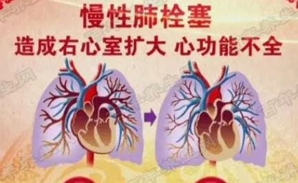 产后血栓有什么症状？