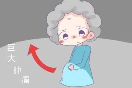 什么是孕期卵巢癌和乳腺癌？