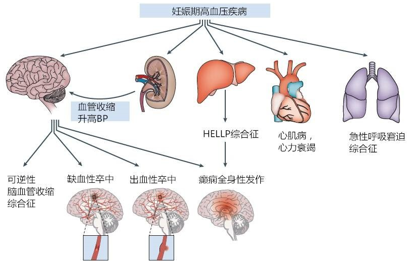妊娠期抗高血压药有哪些？