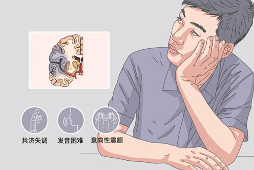 遗传性脊髓小脑共济失调是什么病？如何避免？