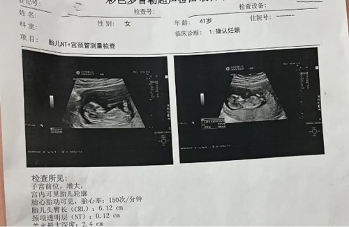 41岁高龄10年不孕，试管3促4移失败，我院试管一次成功！