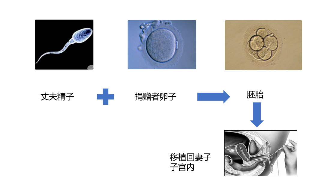 卵巢已经早衰，如何在试管婴儿中逆袭？
