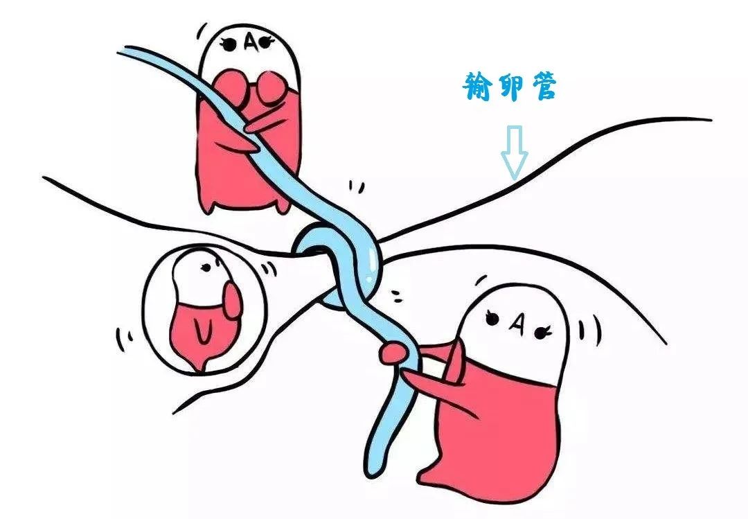 备受输卵管不孕折磨多年，终于怀了！！