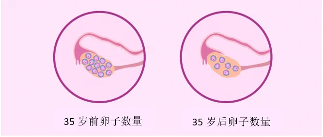 40岁+女性的科学备孕之道