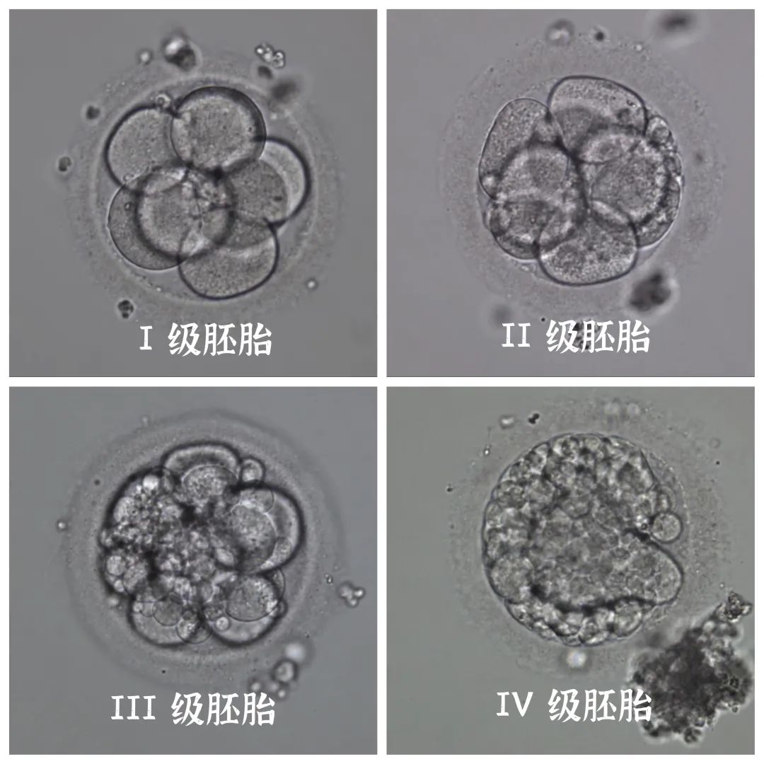 试管婴儿的胚胎质量如何评估