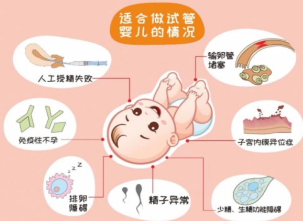 哪些人不能做试管