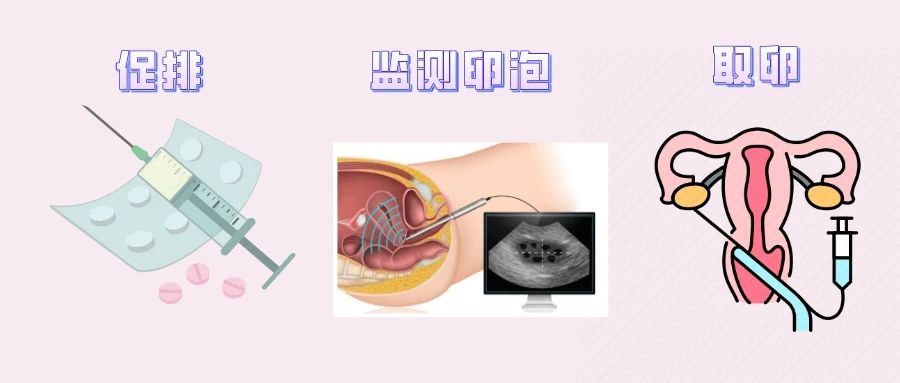 试管婴儿取卵很疼吗？