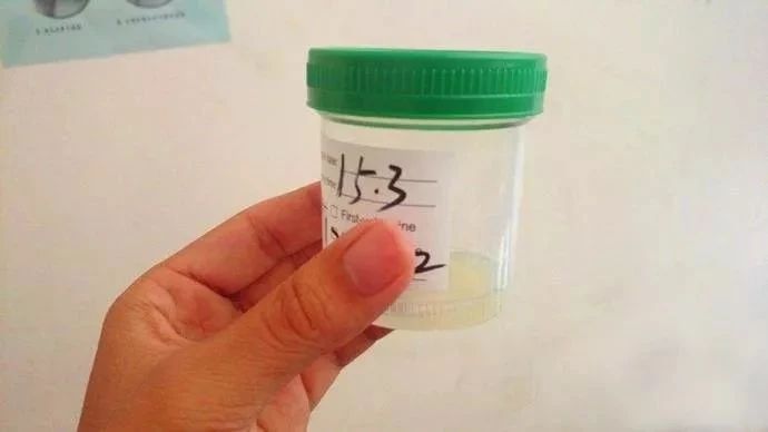 如何成为一名合格的「试管爸爸」?